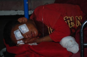 Injured Sameer receiving  treatment at a hospital in Capital. photo:NMF