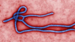 ebola virus