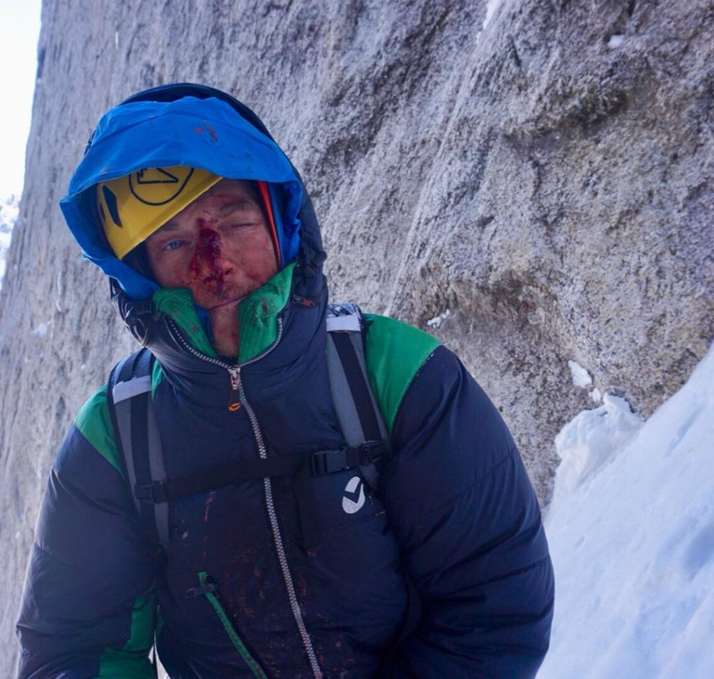 Alan Rousseau ferito dalla caduta di un blocco di ghiaccio - Foto Instagram @Jackson Marvell