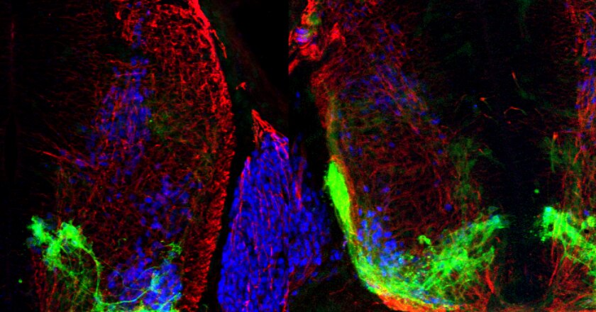 neuroscienze, motoneurone, sistema nervoso, riccardo cassin, Dario Bonanomi, cervello