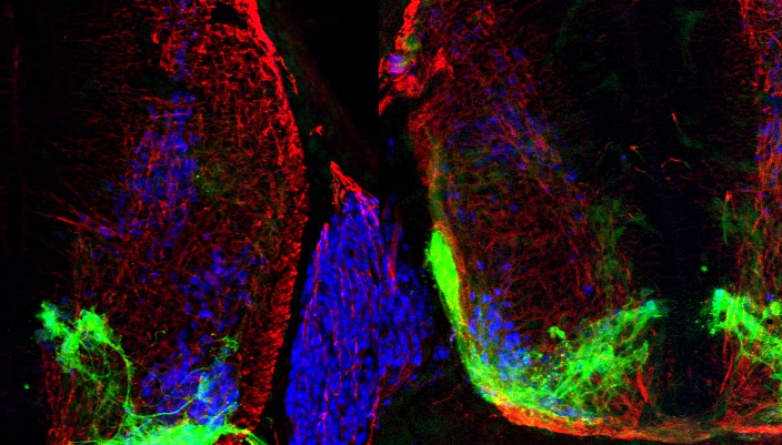 neuroscienze, motoneurone, sistema nervoso, riccardo cassin, Dario Bonanomi, cervello