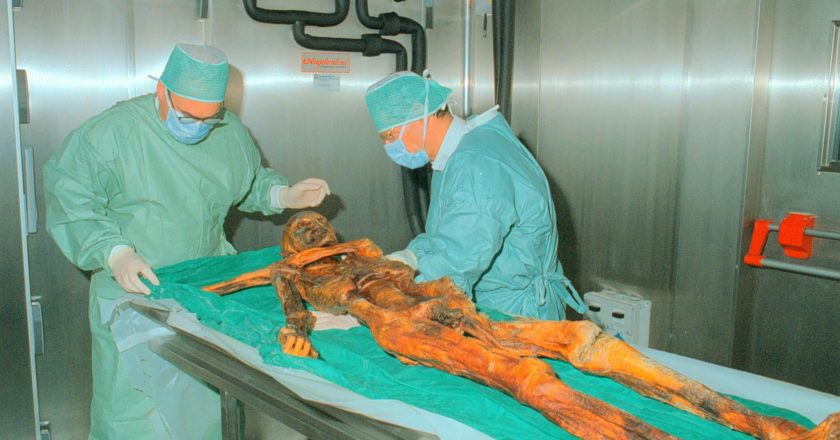 otzi