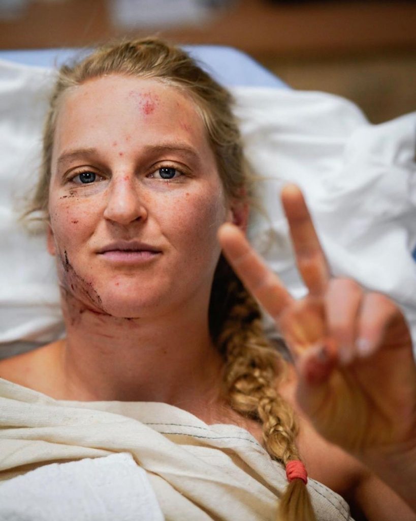 Emily Harrington fa il segno della pace dal letto dell'ospedale di Fresno in cui è ricoverata a seguito dell'incidente su El Cap - Foto Instagram Emily Harrington