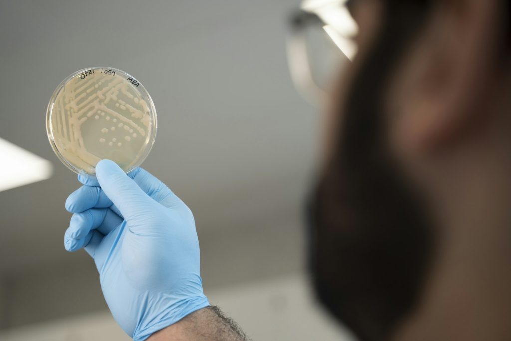Il microbiologo Mohamed Sarhan osserva le colonie di un lievito isolato da un campione prelevato dallo stomaco di Ötzi. Foto Eurac Research / Andrea De Giovanni